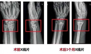 世界性难题,攻克了?