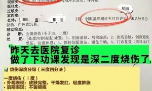 女子上厕所被烫到尖叫弹起!很多人家里都在用……